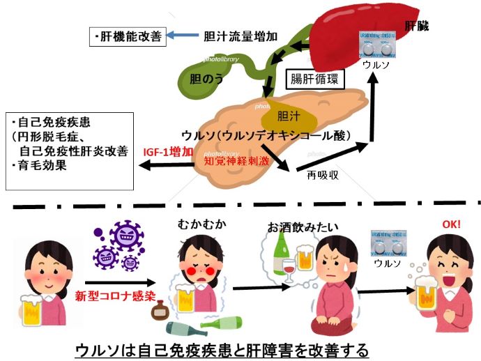 円形脱毛症　病院